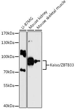 Kaiso Antibody