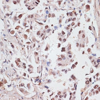 DKC1 Antibody