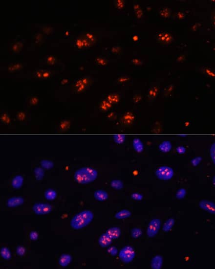 DKC1 Antibody