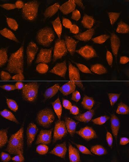 ATP5G2 Antibody