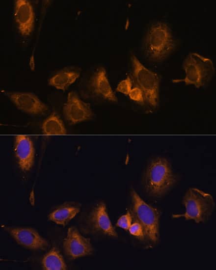 RPL32 Antibody