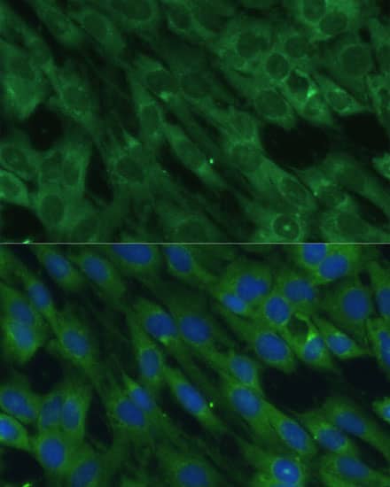 Histidase Antibody