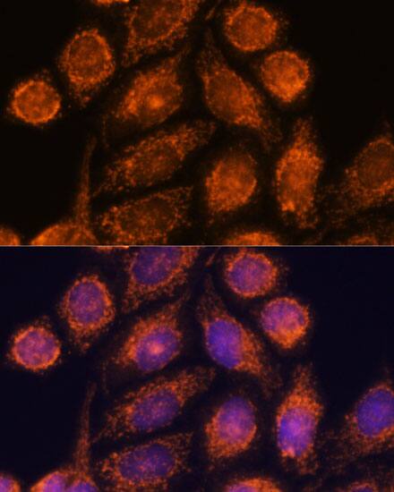 MTMR9 Antibody