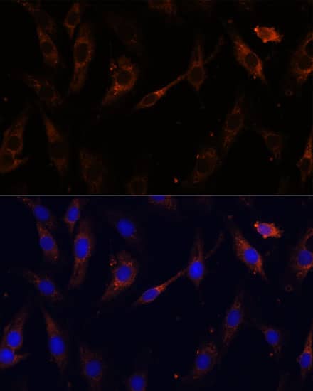 VPS25 Antibody