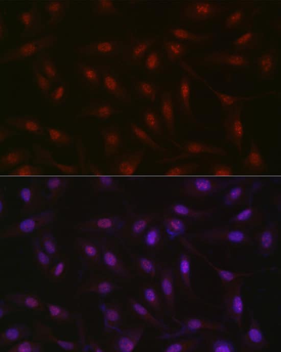 RBM14 Antibody