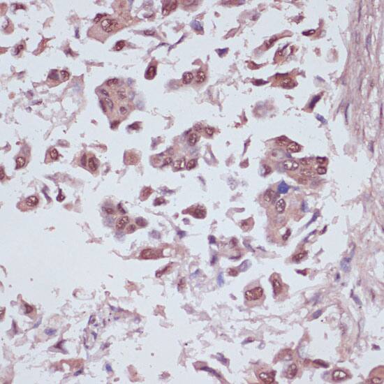 U2AF35 Antibody