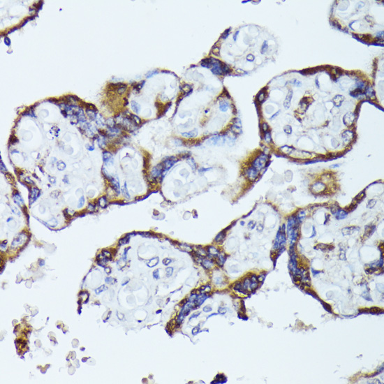 CKAP1 Antibody