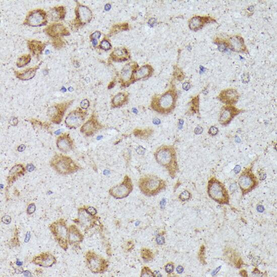 CKAP1 Antibody