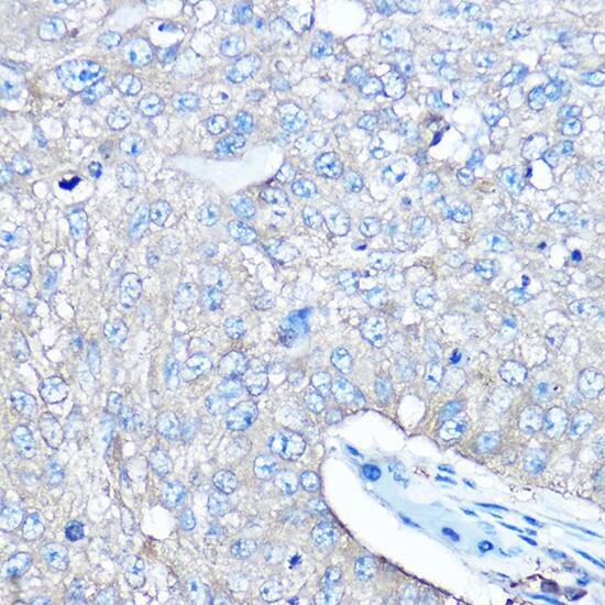 Seryl tRNA synthetase Antibody