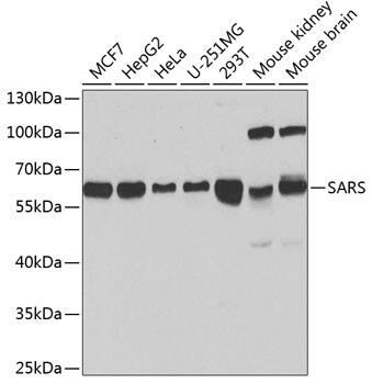 Seryl tRNA synthetase Antibody