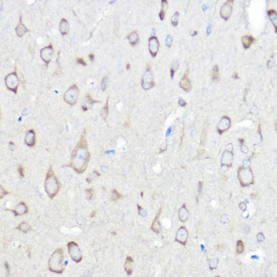 Seryl tRNA synthetase Antibody