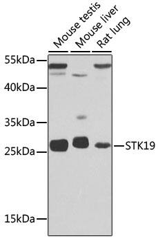 STK19 Antibody