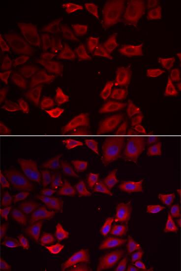 SEPHS1 Antibody