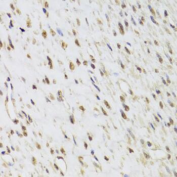 SEPHS1 Antibody