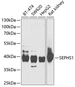 SEPHS1 Antibody