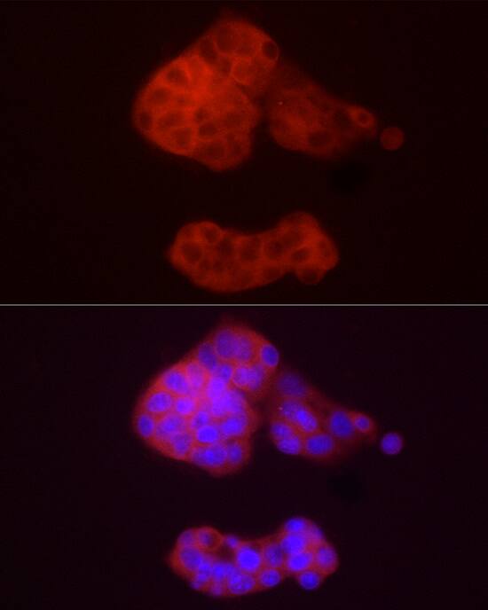 alcohol dehydrogenase 5 Antibody