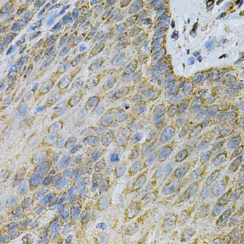 Adenylate Kinase 1 Antibody