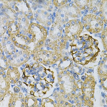 Adenylate Kinase 1 Antibody