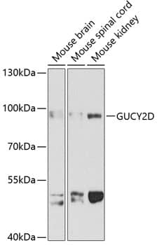 GUCY2D Antibody