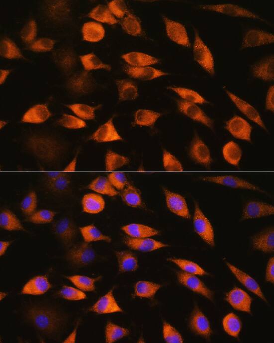 CYP51A1 Antibody