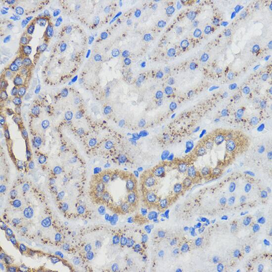 CYP51A1 Antibody