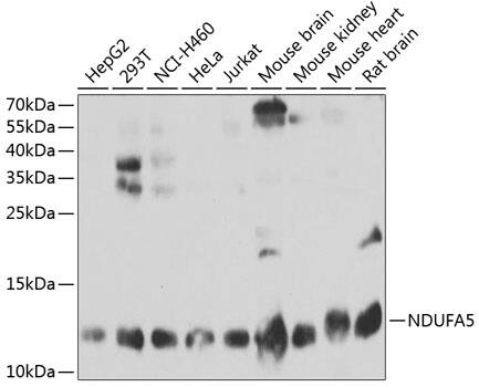 NDUFA5 Antibody
