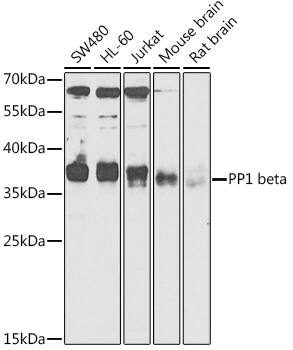 Protein Phosphatase 1 beta Antibody