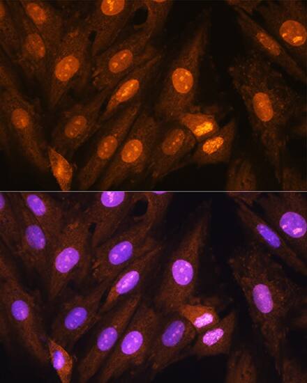 Protein Phosphatase 1 beta Antibody