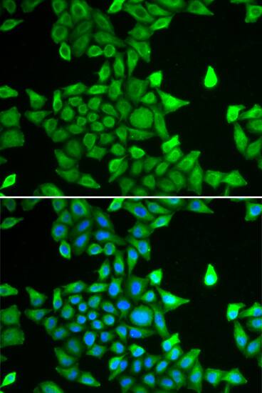 Proteasome 20S alpha 6 Antibody