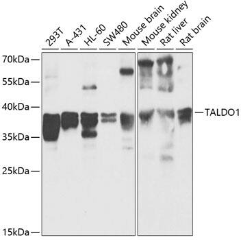 Transaldolase 1 Antibody