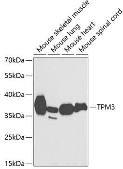 tropomyosin-3 Antibody