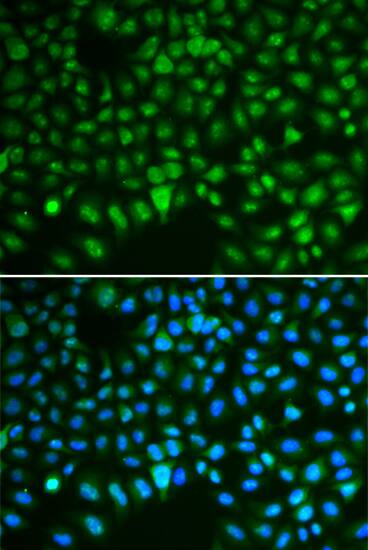 DLG7/HURP Antibody