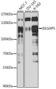DLG7/HURP Antibody