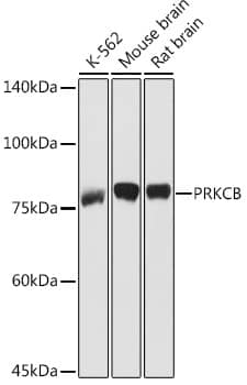 PKC beta Antibody