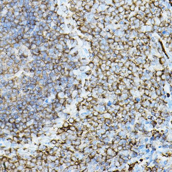 PKC beta Antibody