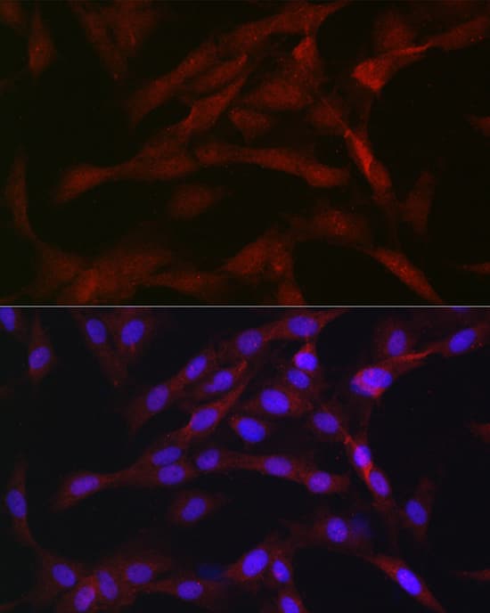 PKC beta Antibody