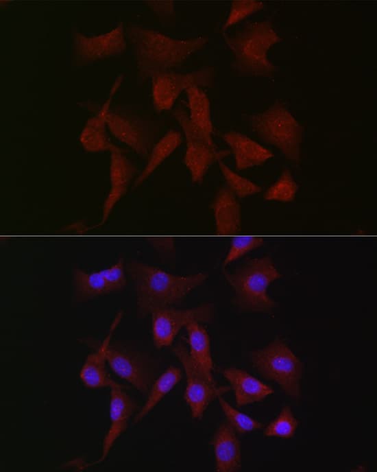 PKC beta Antibody