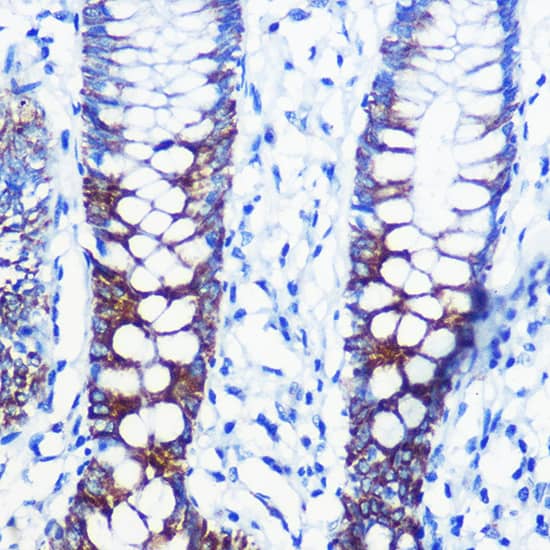 CPT1A Antibody