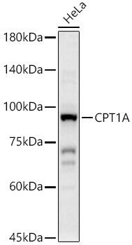 CPT1A Antibody
