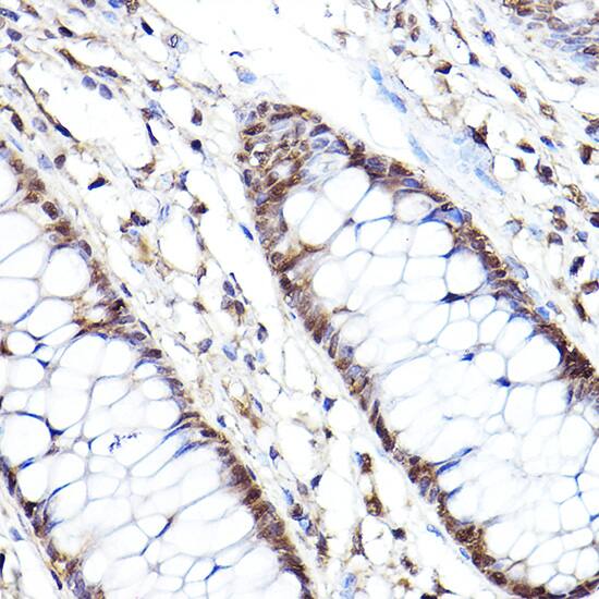 Proteasome 20S beta2 Antibody