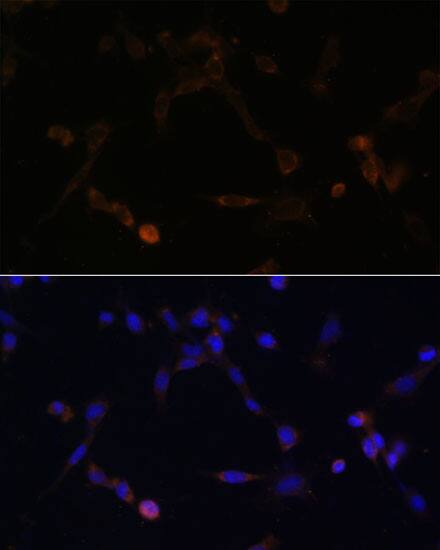 UbcH8/Ube2L6 Antibody