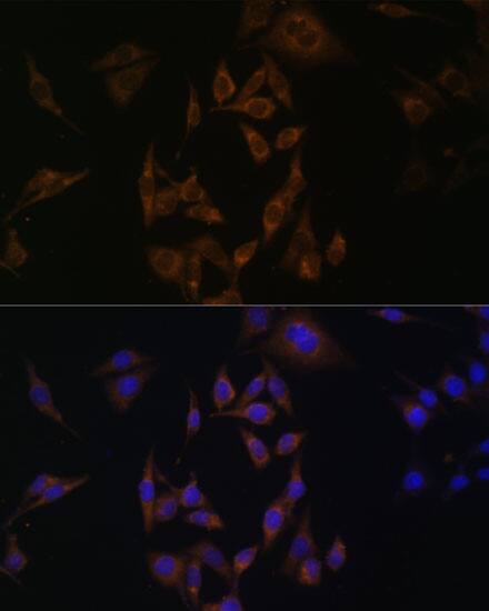 UbcH8/Ube2L6 Antibody