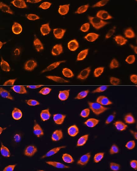 RND1 Antibody