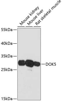 DOK5 Antibody