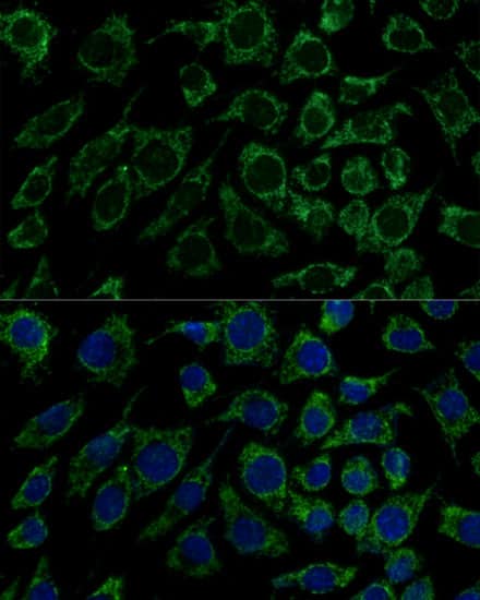 IDH3B Antibody