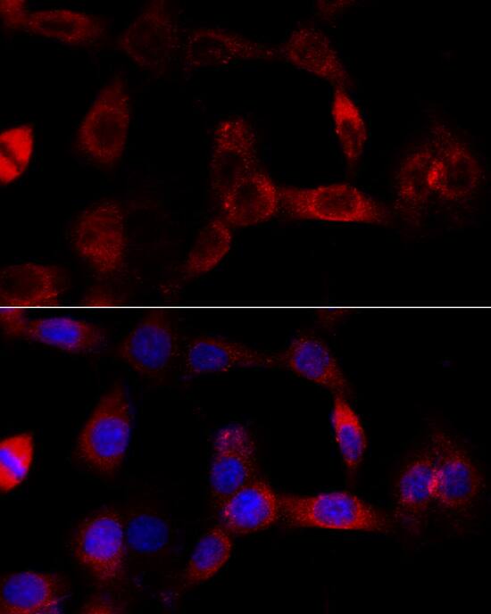 CYP1B1 Antibody