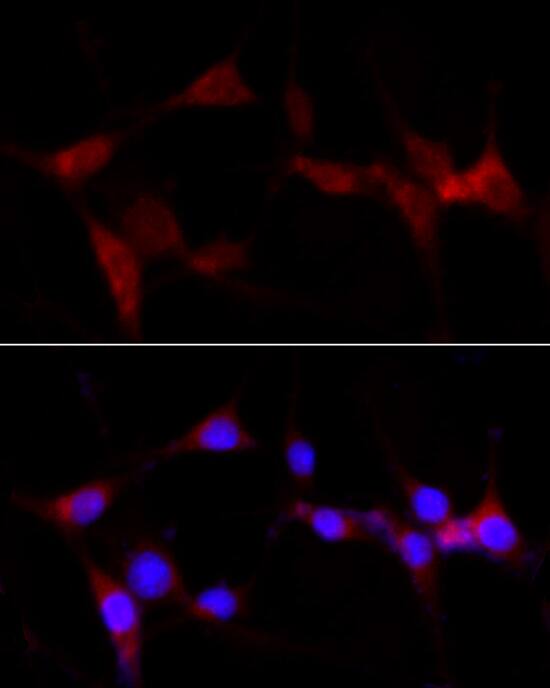 CYP1B1 Antibody