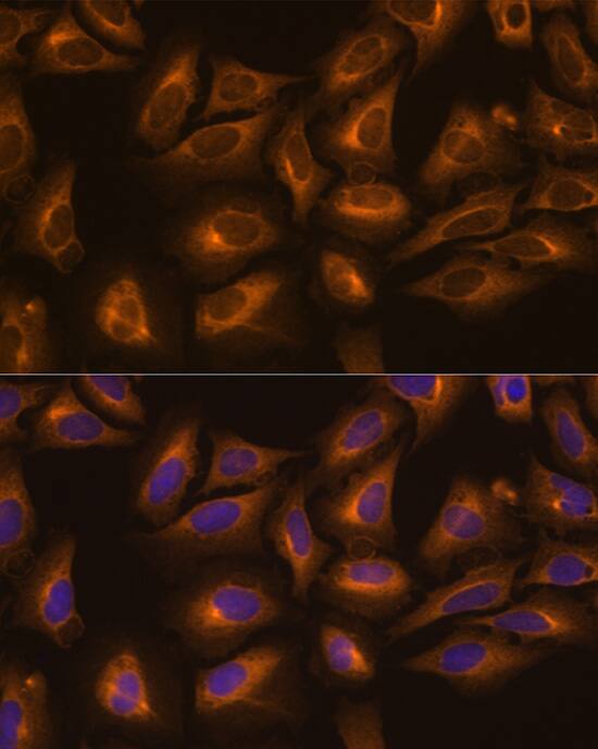 Lysyl tRNA synthetase Antibody