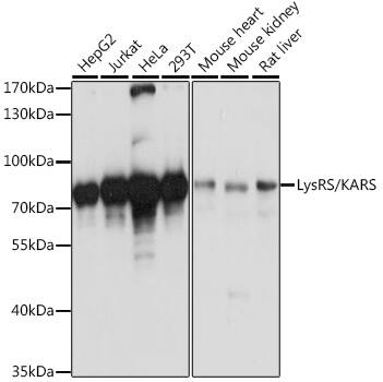 Lysyl tRNA synthetase Antibody