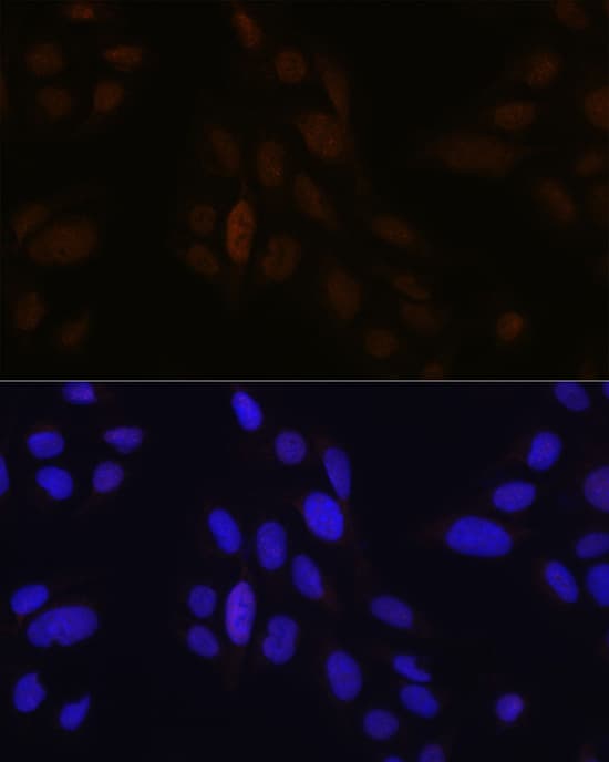 Pea3 Antibody